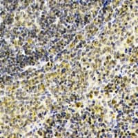 SEPT1 / Septin 1 Antibody (Internal)