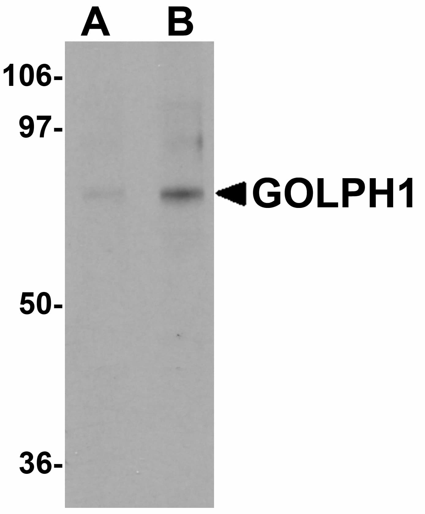 GCP60 / ACBD3 Antibody