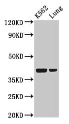 PTX3 / Pentraxin 3 Antibody