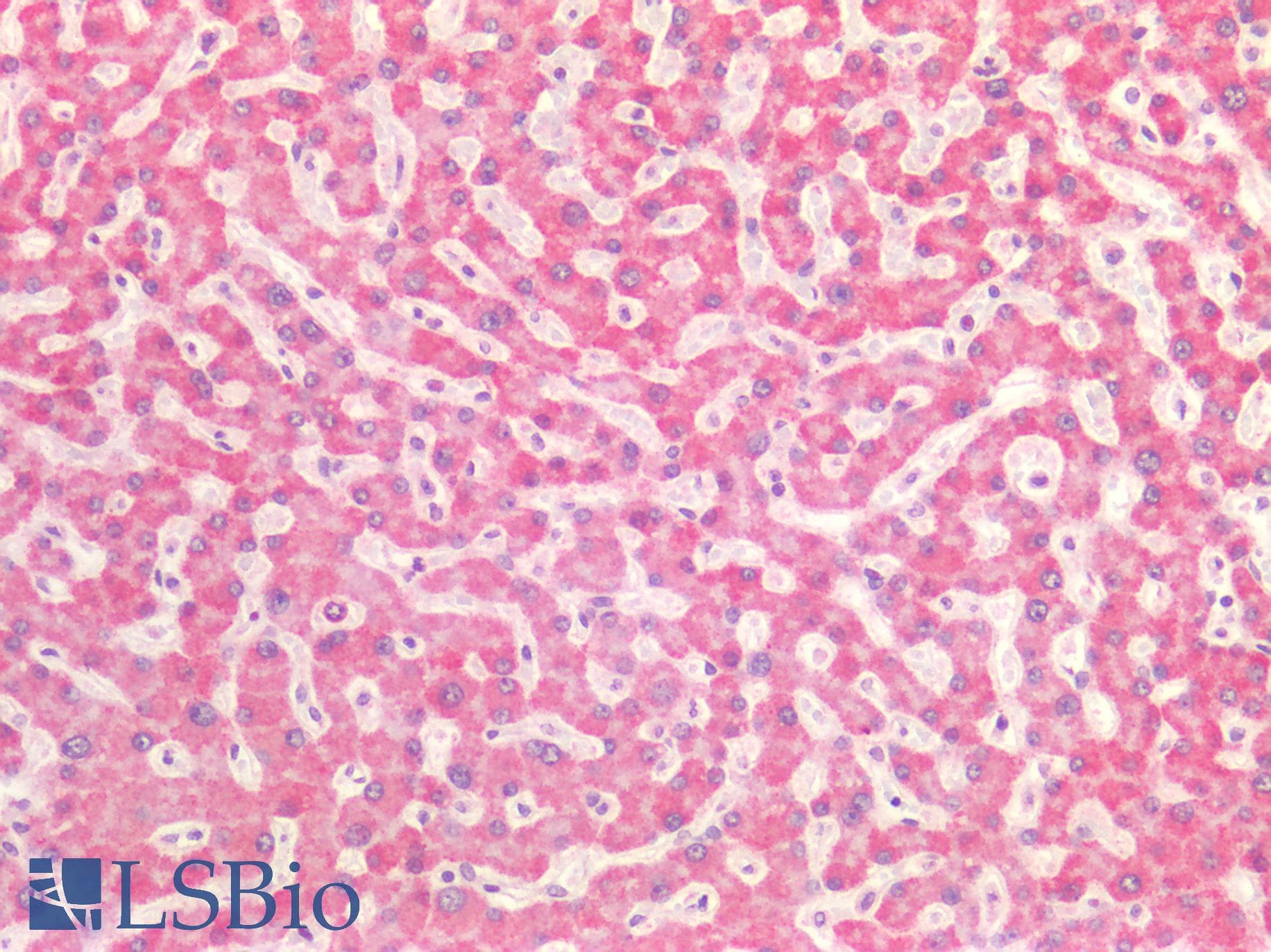 PathPlus™ Polyclonal Goat anti-Human SDHB Antibody (aa271-280, IHC, WB)