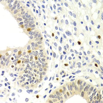 Polyclonal Rabbit anti-Human SIP1 Antibody (IHC, IF, WB)