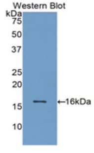 ADM / Adrenomedullin Antibody (aa22-147)