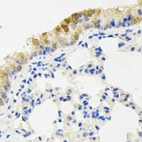 Polyclonal Rabbit anti-Human KIF2B Antibody (IHC, IF, WB)