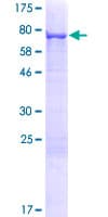 Human KRT71 / Keratin 71 Protein (Recombinant GST)