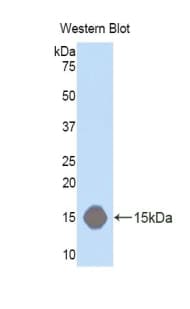 LRP1 / CD91 Antibody (aa4441-4544)