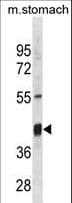 TXNIP Antibody (aa116-145)