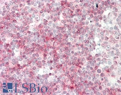 IHC-plus™ CD79A / CD79 Alpha Antibody (sequence AA 200+ of human CD79a protein, clone SP18)