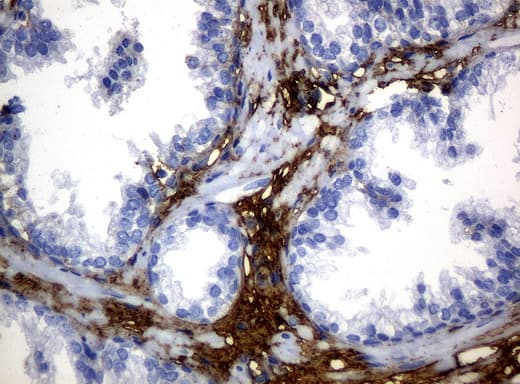 HP / Haptoglobin Antibody (clone UMAB10)