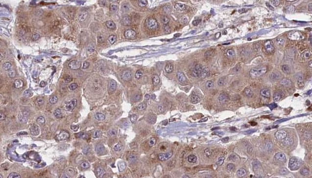 BVES Antibody