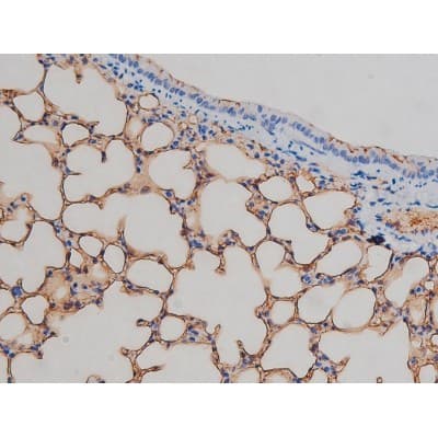 IGF1R / IGF1 Receptor Antibody (phospho-Tyr1161)