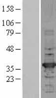 HADH Protein (Over-Expression Lysate Myc-DDK (Flag))