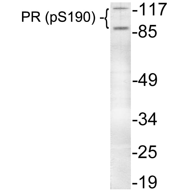 PR / Progesterone Receptor Antibody (phospho-Ser190)