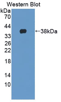 NCAN / Neurocan Antibody (aa949-1214, PE)