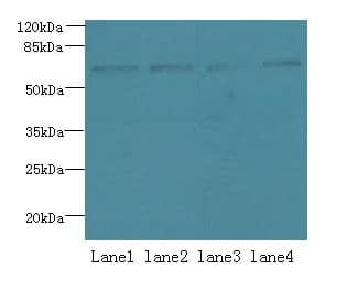 Polyclonal Rabbit anti-Human CSGALNACT2 Antibody (IHC, WB)