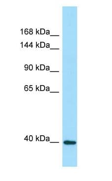 DRP2 Antibody (aa178-227)