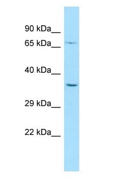 PALMD Antibody (aa23-72)
