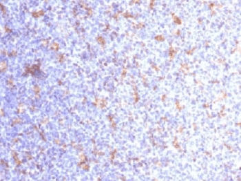 ITGAX / CD11c Antibody (clone ITGAX/1284)