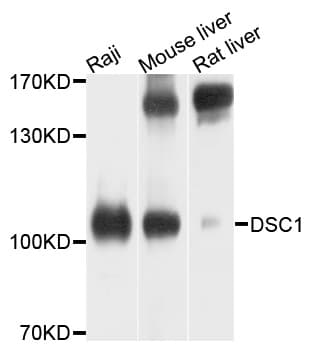 IHC-plus™ Polyclonal Rabbit anti-Human DSC1 / Desmocollin 1 Antibody (IHC, WB)