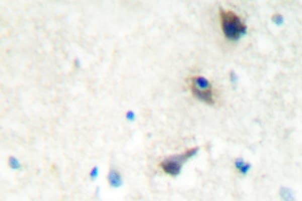 LIMK1 / LIMK Antibody (Gln491)