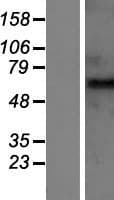 GABRB2 Protein (Over-Expression Lysate Myc-DDK (Flag))