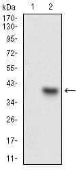 C1qRP / CD93 Antibody (aa474-535, clone 2F7D11)