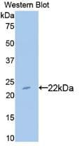 BLMH Antibody (aa30-165)