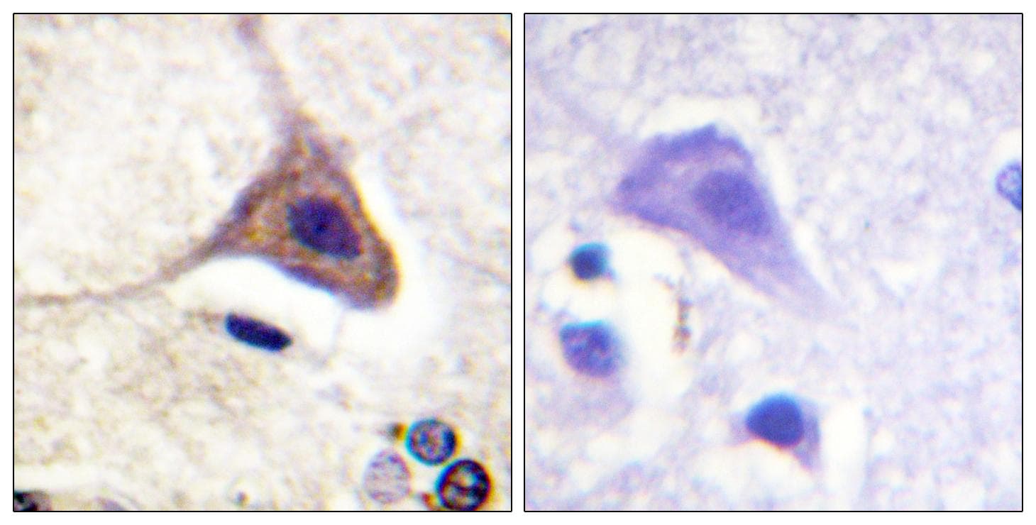 OPRD1 / Delta Opioid Receptor Antibody (phospho-Ser363)