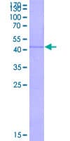 Human LECT2 Protein (Recombinant GST)