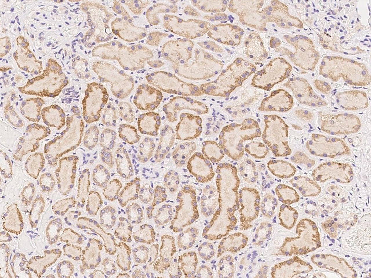 Polyclonal Rabbit anti-Human FER1L6 Antibody (IHC)