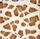 TBC1D4 / AS160 Antibody (aa172-201)