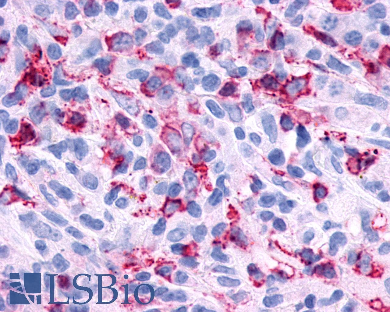 PathPlus™ Polyclonal Rabbit anti-Human P2RY6 / P2Y6 Antibody (Cytoplasmic Domain, IHC)