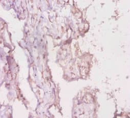 LBA / LRBA Antibody