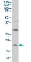 LMO2 Antibody (clone 6B8)