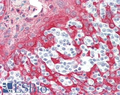 IHC-plus™ CTTN / Cortactin Antibody (aa450-500)