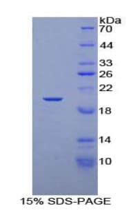 Rat TCEB3 / Elongin A Protein (Recombinant His-T7)