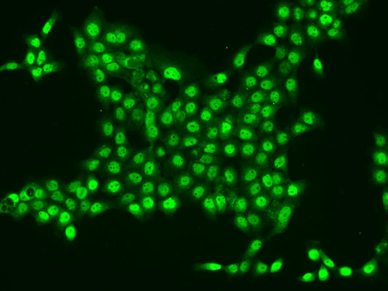 Polyclonal Rabbit anti-Human CYTIP Antibody (IHC, IF)