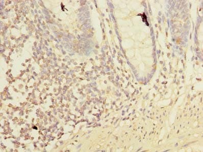 Polyclonal Rabbit anti-Human DAT1 / LMO3 Antibody (IHC, WB)