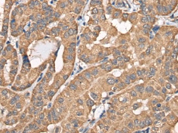 Polyclonal Rabbit anti-Human BCHE / Cholinesterase Antibody (IHC)