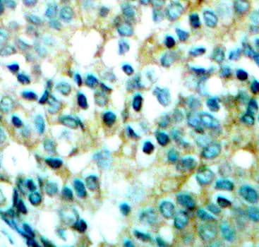 SRC Antibody (phospho-Tyr418)