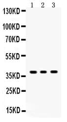 SIRT6 / Sirtuin 6 Antibody (aa14-180)