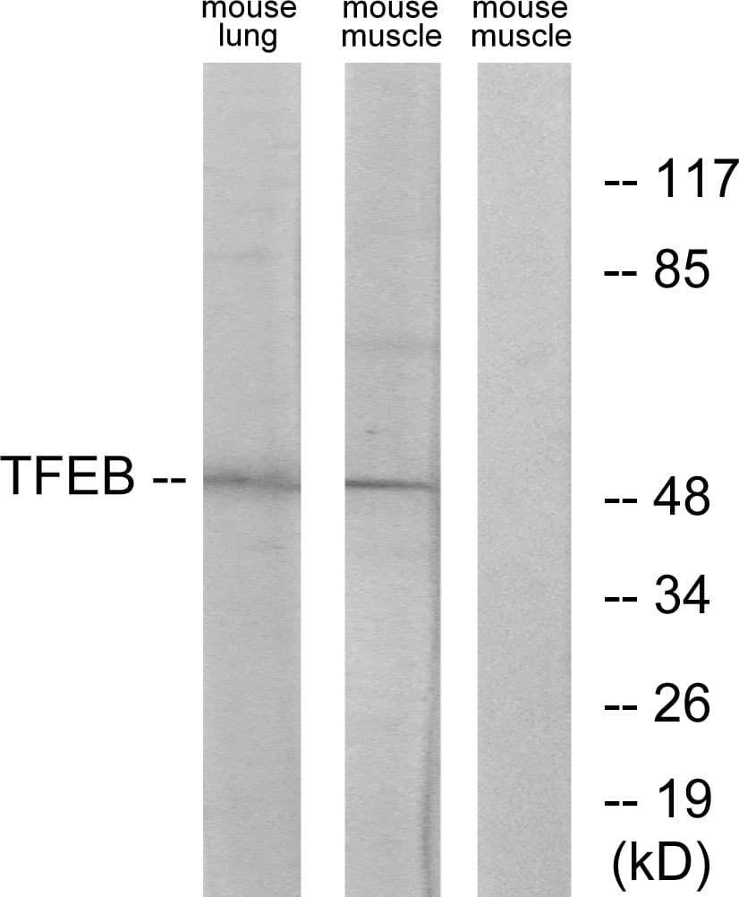 TFEB Antibody (aa10-59)