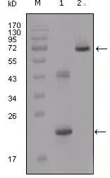 IGFBP2 / IGF-BP53 Antibody (clone 1F6F6)