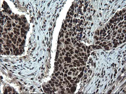RPRD1B Antibody (clone OTI1C9)
