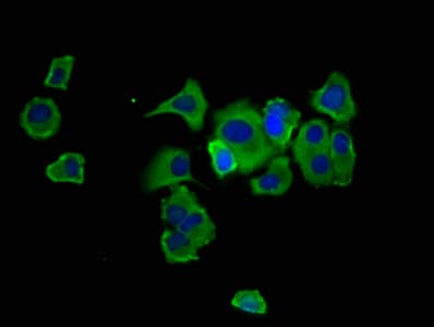 HPN / TMPRSS1 / Hepsin Antibody