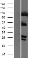 Human COMMD4 Protein (Over-Expression Lysate Myc-DDK (Flag))