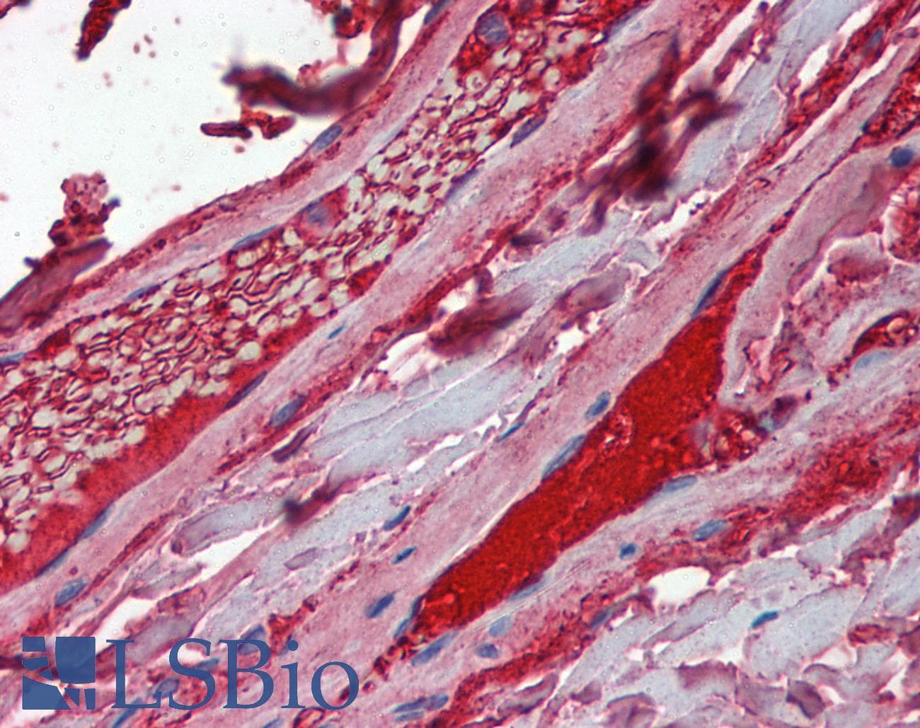 IHC-plus™ F10 / Factor X Antibody