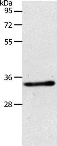 ACY3 Antibody