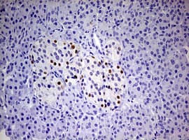 PR / Progesterone Receptor Antibody (aa1-298, clone OTI4B3)