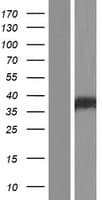RAD51 / RECA Protein (Over-Expression Lysate Myc-DDK (Flag))