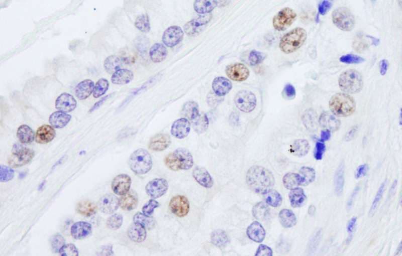 Polyclonal Rabbit anti-Human NONO / P54NRB Antibody (aa1-50, IHC, WB)